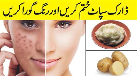 Remove Sun Tan And Dark Spots From Face Naturallyhomemade Remedy For