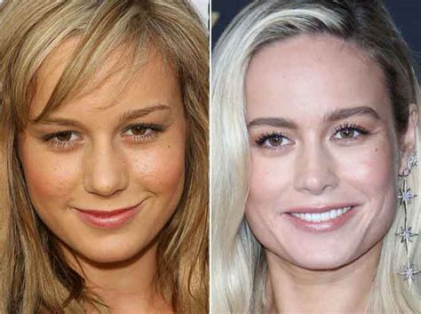 Brie Larson Plastic Surgery Nose Job Boob Job Forehead Surgical