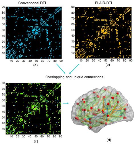 Backbone Connectivity Matrices Of The Human Brain Anatomical Networks Download Scientific