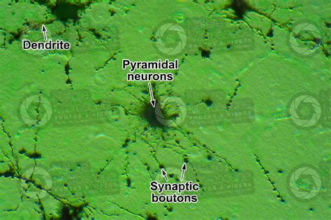 Mammal Cerebral Cortex Neuron Silver Stain Contrasting Colour X