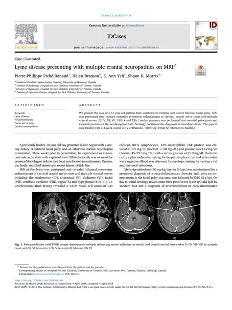 Pdf Lyme Disease Presenting With Multiple Cranial Neuropathies On Mri