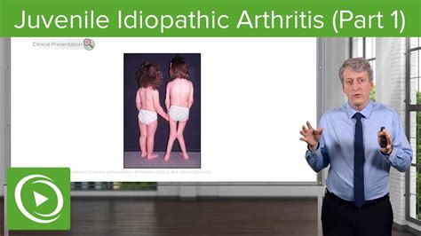 Juvenile Idiopathic Arthritis