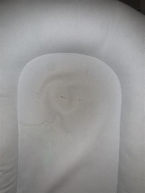 Do you think this looks like bed bug smears : r/Bedbugs