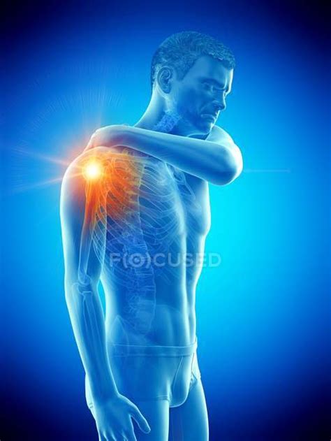 Silhouette Of Man Having Shoulder Pain Conceptual Illustration