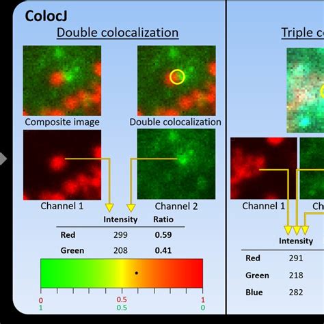 Triple Colocalization Analysis Of Hcv Live Cell Image Sequence Using