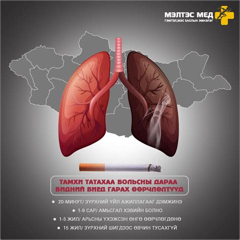 🚭 Тамхи гэж юу вэ?... - Meltes MED orthoplastic hospital