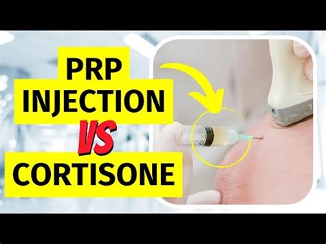 Prp Vs Cortisone Injection For Tennis Elbow Youtube