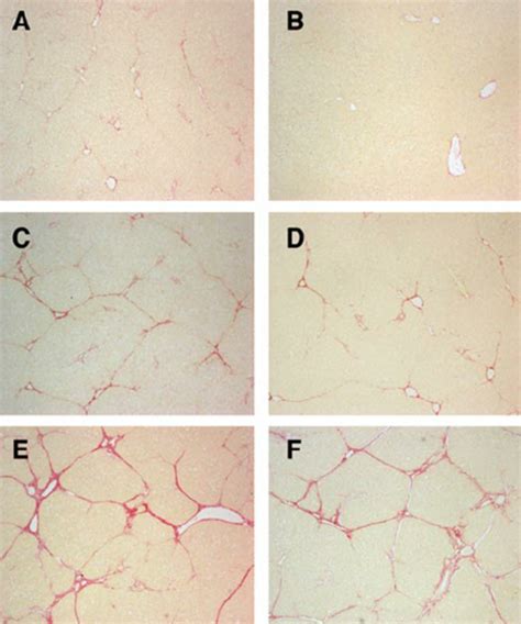 Histological Assessment By Sirius Red Staining Of Liver Sections From
