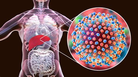 Hepatitis qué tipos hay y cómo diferenciarlos