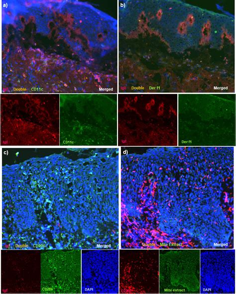 Double Immunofluorescence Staining For Skin Lesions In Control Download Scientific Diagram