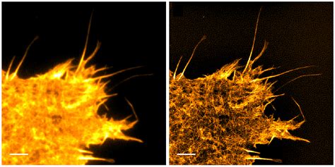 Total Internal Reflection Fluorescence (TIRF) Microscopy