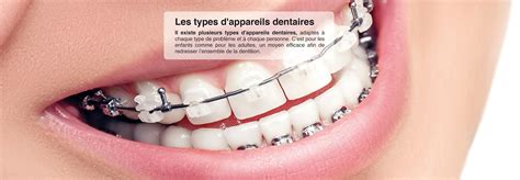 Types Dappareils Dentaires Dr Bailloeuil