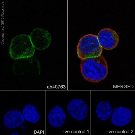 Endothelial Cell Marker (CD31, CD34, ICAM1, CD45) Antibody Sampler ...