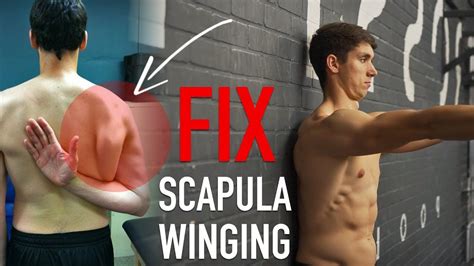 Fix Scapula Winging Full Routine Artofit