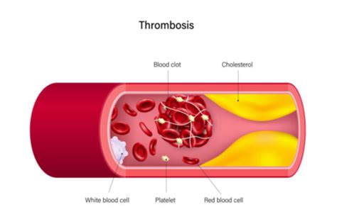 Cardiovascular Physiology Chapter 8 Homeostasis Coagulation