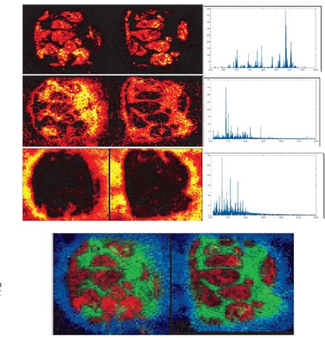 Figure From An Investigation Into Multi Model Tissue Imaging On A