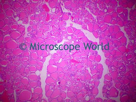 Microscope World Blog Human Thyroid Gland