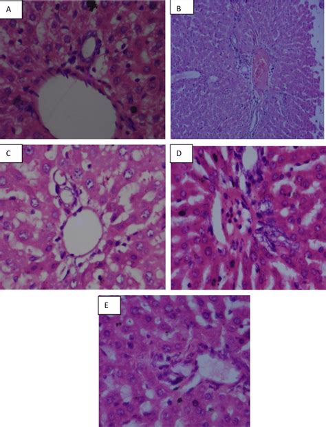 Photomicrograph Of The Liver Tissues H E X Of Albino Wistar Rats