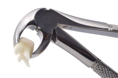 Wisdom Tooth Extraction Tools