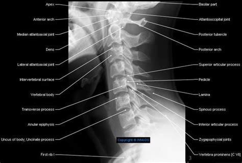 Radiographie Du Rachis Cervical Incidence Cliché De Profilrachis