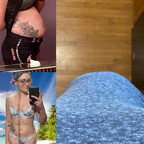 Belly button pain : r/endometriosis