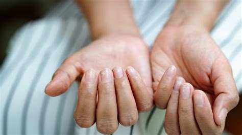 Brittle Nails Causes Symptoms And Treatments Mamabella