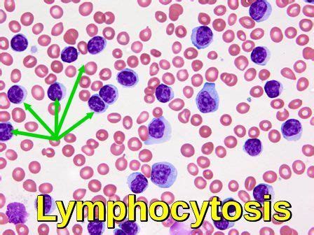 Common Hematology Tests Ask Hematologist Understand Hematology