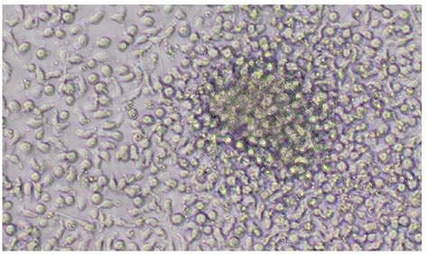 Expansion And Differentiation Of Hematopoietic Stem And Progenitor