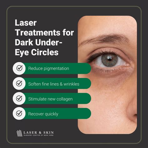 Laser treatment for dark under-eye circles in New York - Laser NY