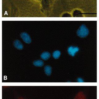 Intracellular Distribution Of Protein P1 A HeLa S3 Cells In Phase