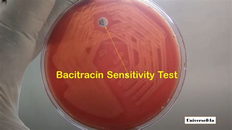 Bacitracin Sensitivity Test Introduction Principle Test Procedure And Res