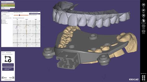 Software para odontología exocad smart optics Sensortechnik GmbH