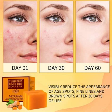 Kojic Acid Soap Before and After: Does It Really Lighten Skin? - Must Read This Before Buying