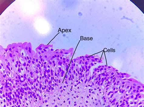 Transitional Epithelium