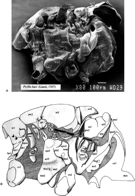 A Scanning Electron Micrograph Showing External Lateral View Of Thorax