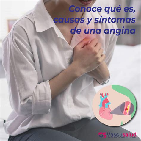 Conoce qué es causas y síntomas de una angina