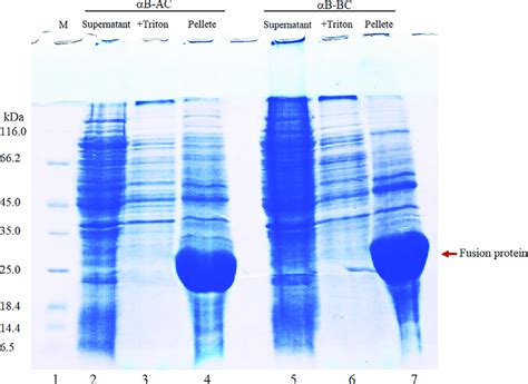 The Sds Page Analysis Of The Fusion Proteins Expression And