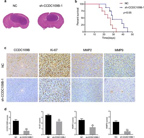 Knockdown Of Ccdc109b Suppresses Glioma Progression In Vivo A He