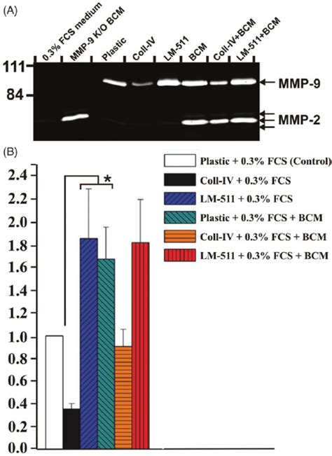 Zymographic Analysis Of Mmp Levels In T Bm Cells T Bm Cells