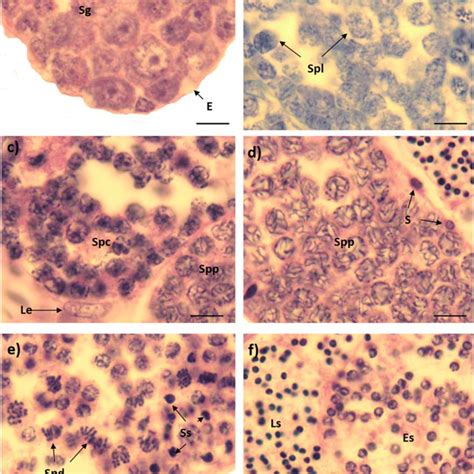 Histological Structure Of The Testis And Efferent Duct Of Millerichthys