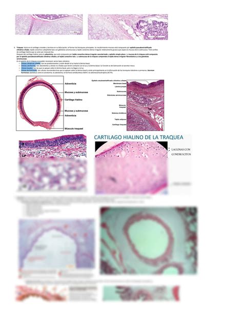 SOLUTION Histología del sistema respiratorio Studypool