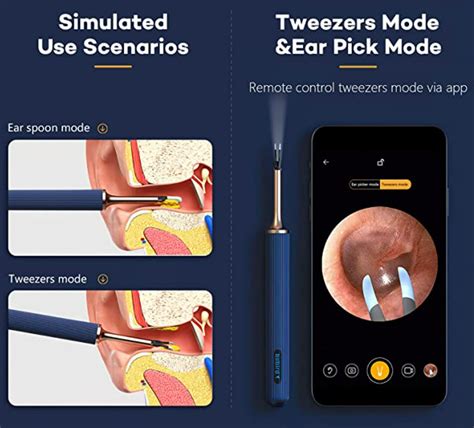 Bebird Note 3 Pro Smart Visual Ear Cleaner Safe And Hygienic Solution