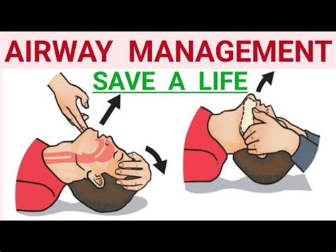 Airway Management Chin Lift Jaw Thrust Technique Head Tilt Chin Lift