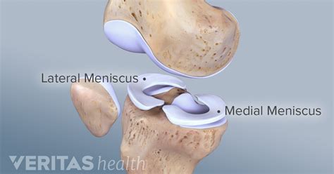 Lateral Meniscus Anatomy