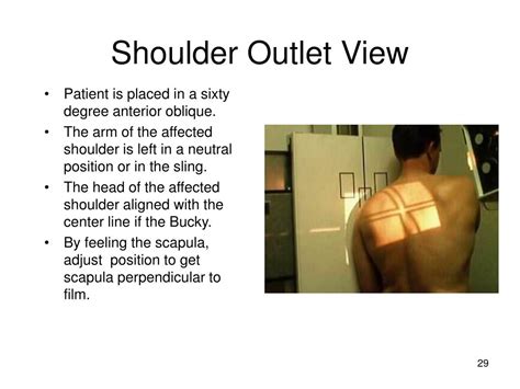 Ppt 141 Shoulder Radiography Powerpoint Presentation Free Download