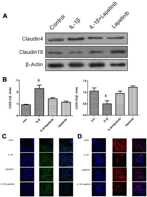 The Il Her Cldn Cldn Axis Mediates Lung Barrier Damage In Ards