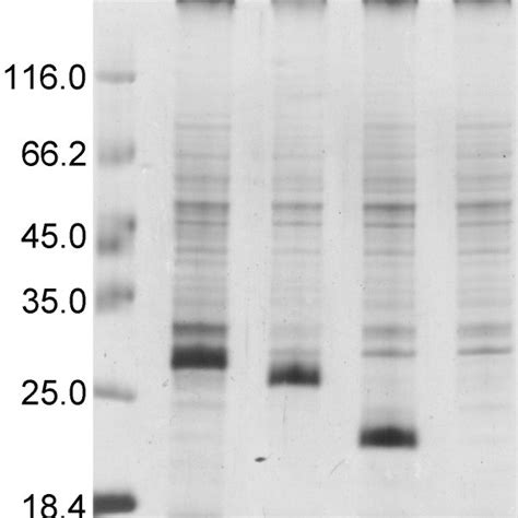 Immunodetection Of Recombinant Hbv Proteins A Sds Page Of Purified