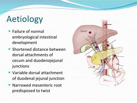 Mesenteric Torsion Pathology And Management