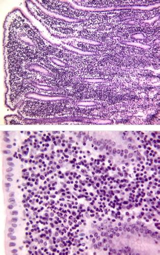 Histology Of Lymphoid Flashcards Quizlet