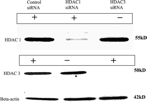 Knockdown Of Hdac By Isoform Specific Sirna Western Blot Analysis